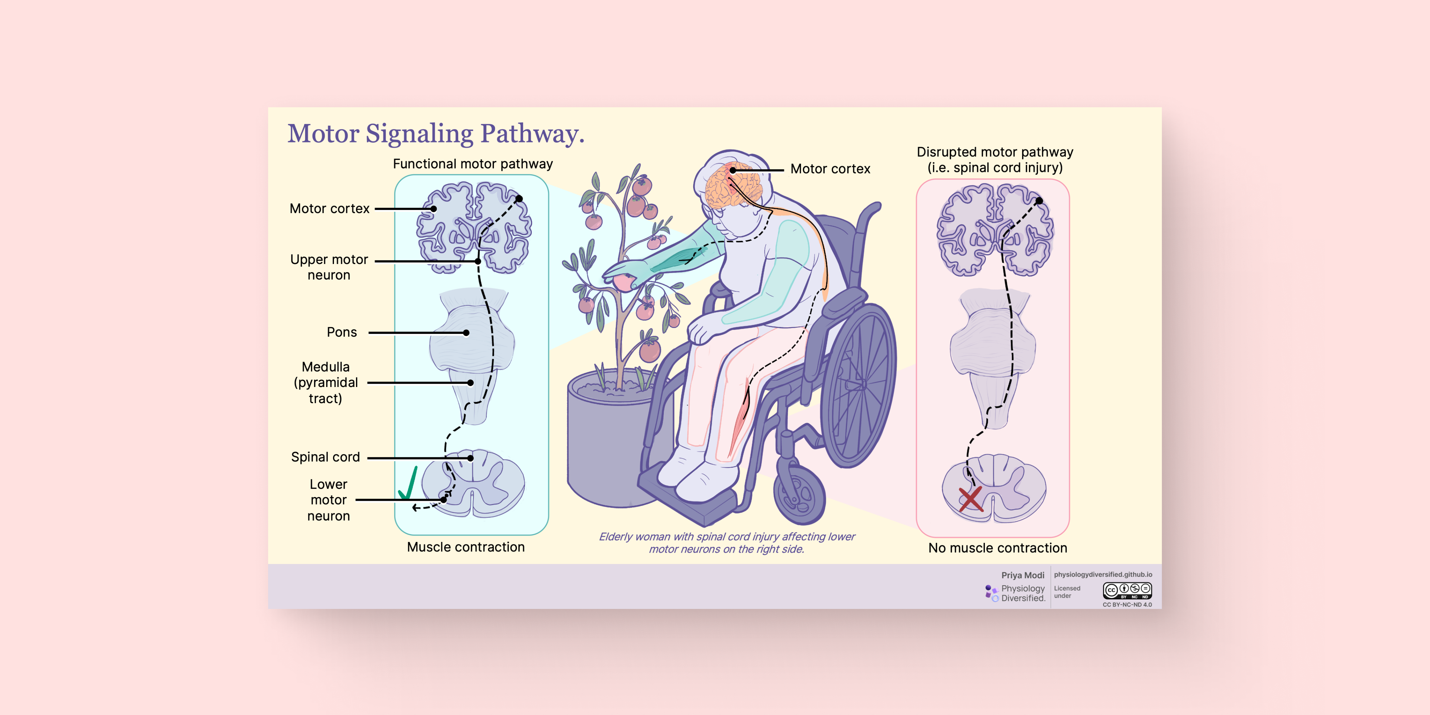 Motor Signaling Pathway and Spinal Injury Impairment
